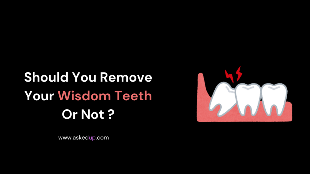 Should You Remove Your Wisdom Teeth Or Not