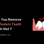 Should You Remove Your Wisdom Teeth Or Not